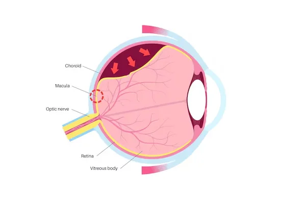 Medical and Vitreo Retina